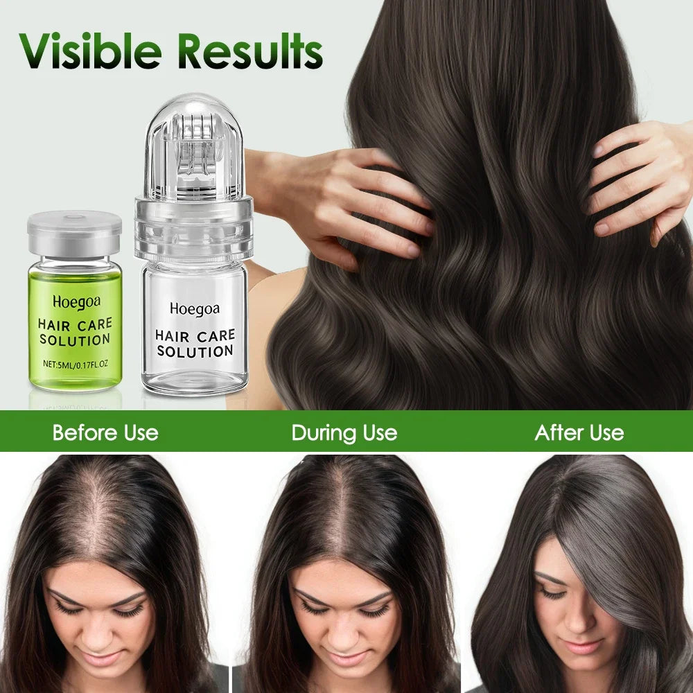 Hair Growth Serum – Strengthening Scalp Treatment for Thinning Hair